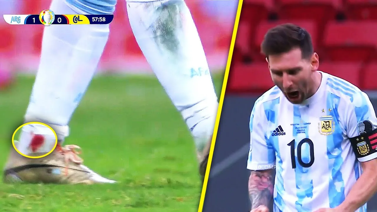 3 Times Lionel Messi Destroyed Everyone With an Injury !